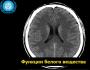 Белое вещество спинного мозга, основные параметры и функции Белое вещество головного мозга человека функции